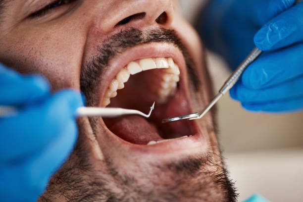Best Emergency Tooth Extraction in Eaton Rapids, MI
